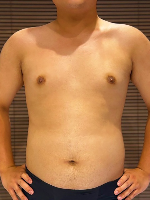 小暮