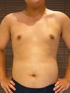 小暮