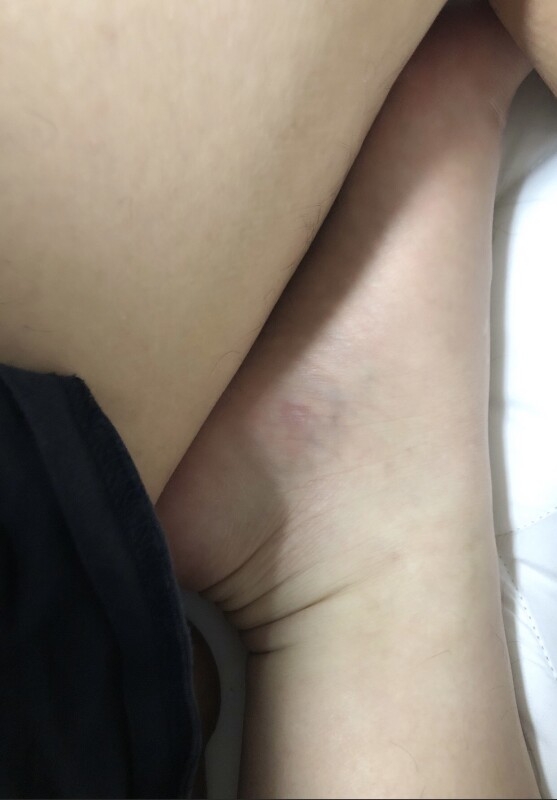 今日は中村の足と太ももを☺️